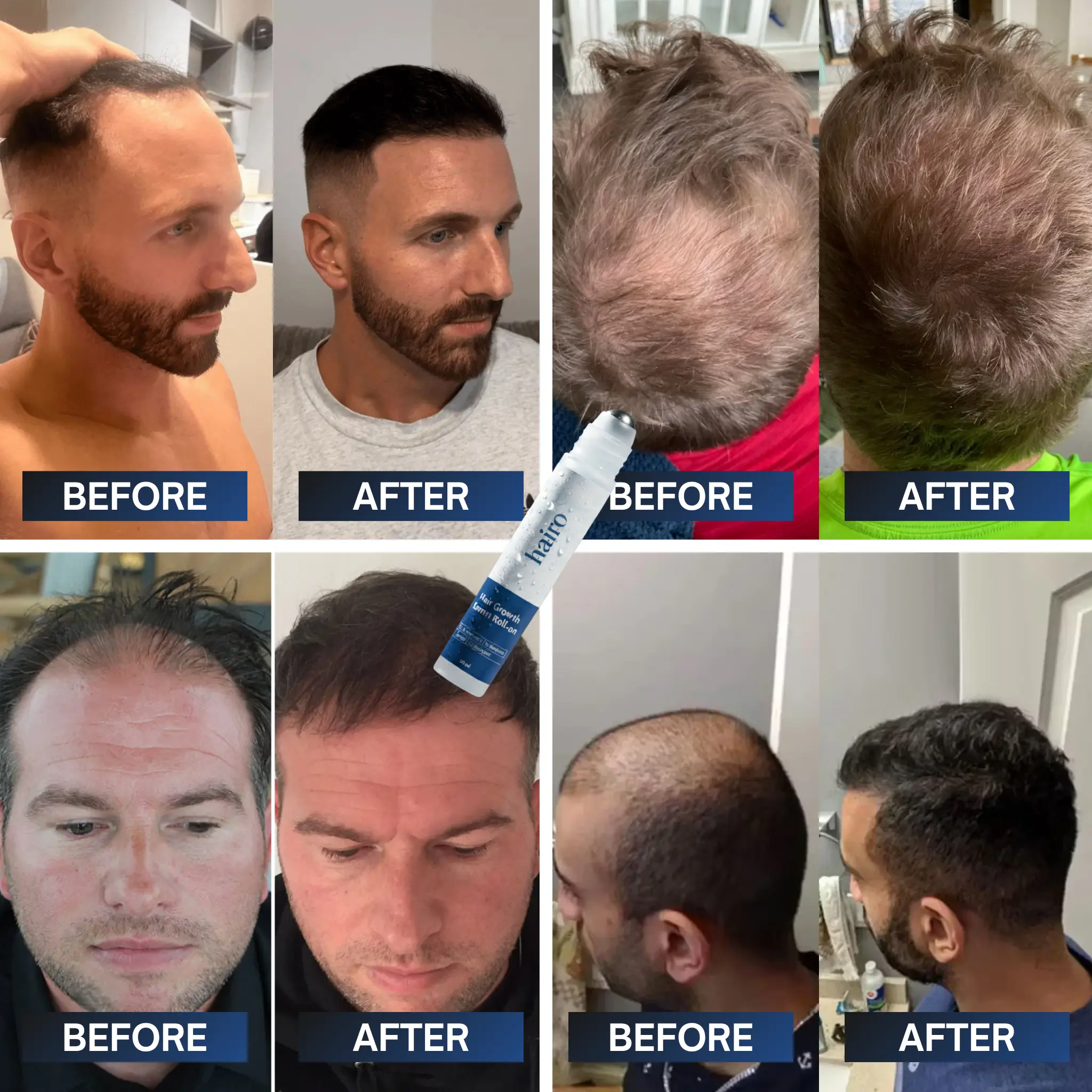 Advanced Hair Growth Roll-On Serum - Image 3