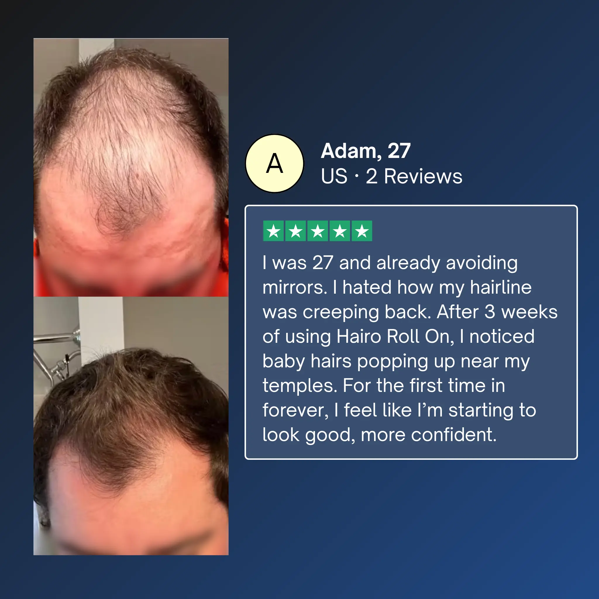 Advanced Hair Growth Roll-On Serum - Image 7