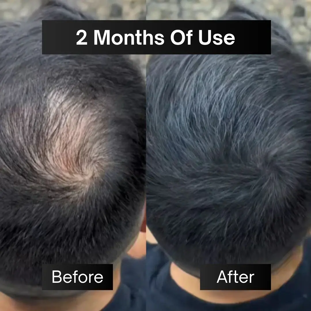Anti Hair Loss & Hair Growth Serum - Image 5