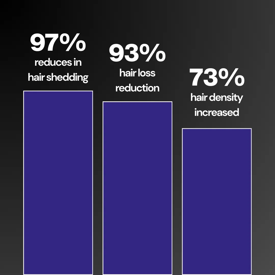 Anti Hair Loss Shampoo - Image 3