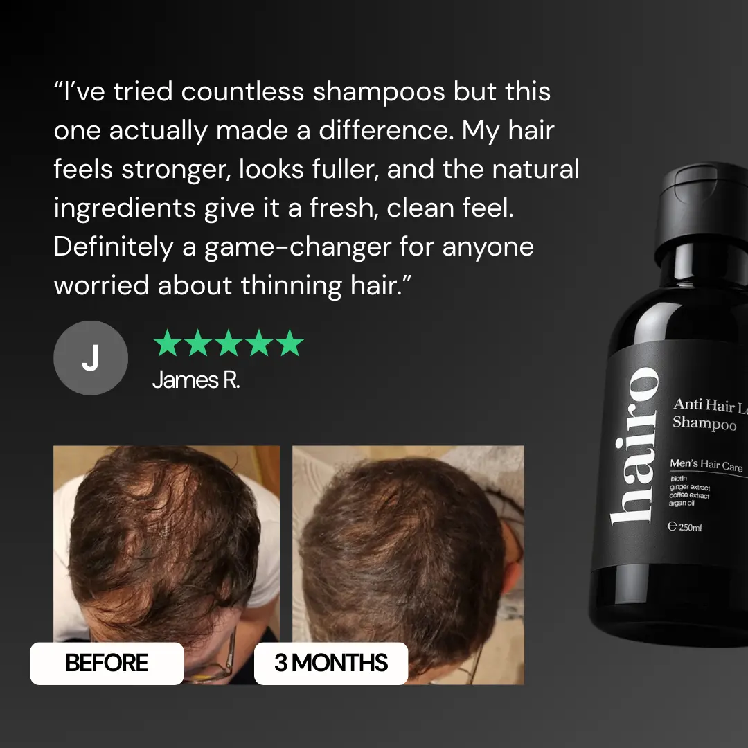 Anti Hair Loss Shampoo - Image 4