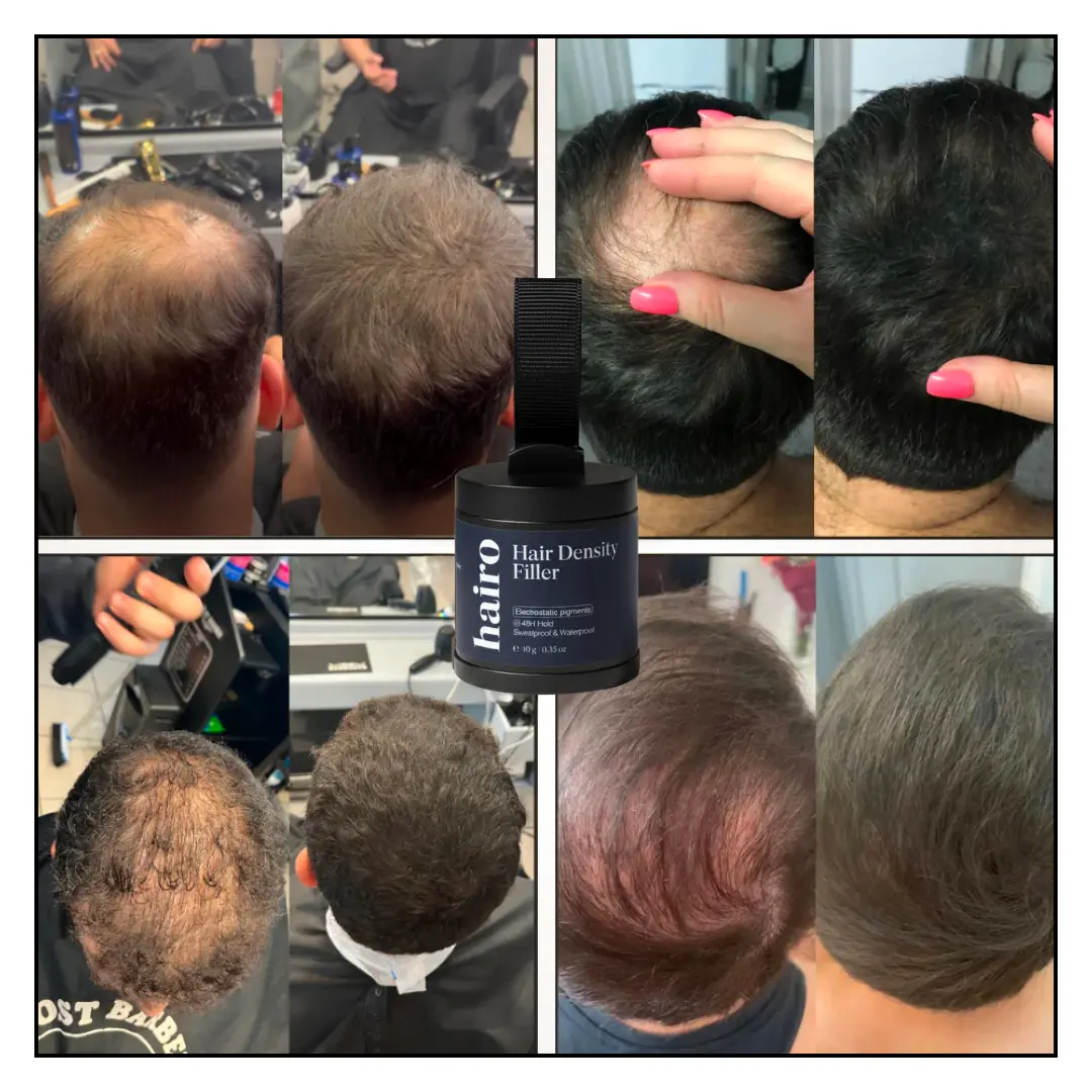 Hair Density Filler - Image 3