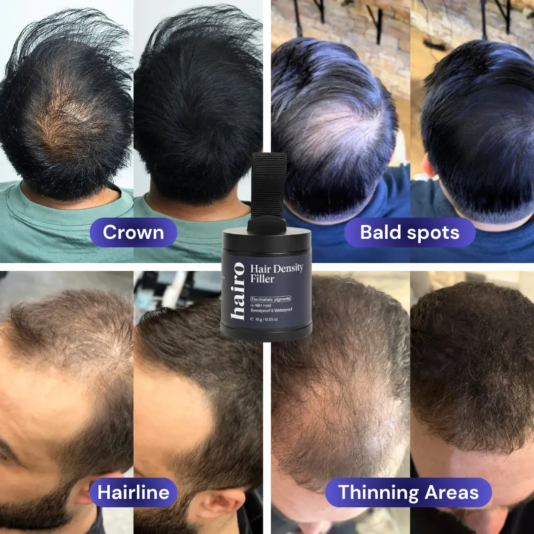 Hair Density Filler - Image 6